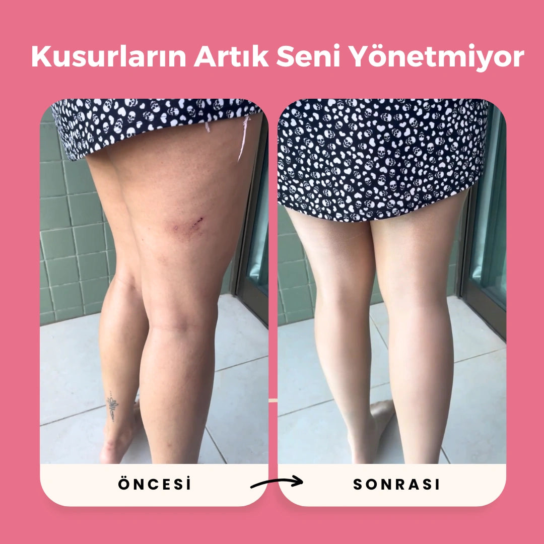 Zumoskin™ Anti-Selülit Külotlu Çorap